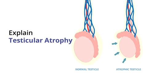 why do my balls hang low|Testicular Atrophy: Symptoms, Causes, and .